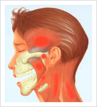 顎関節痛の痛む部分